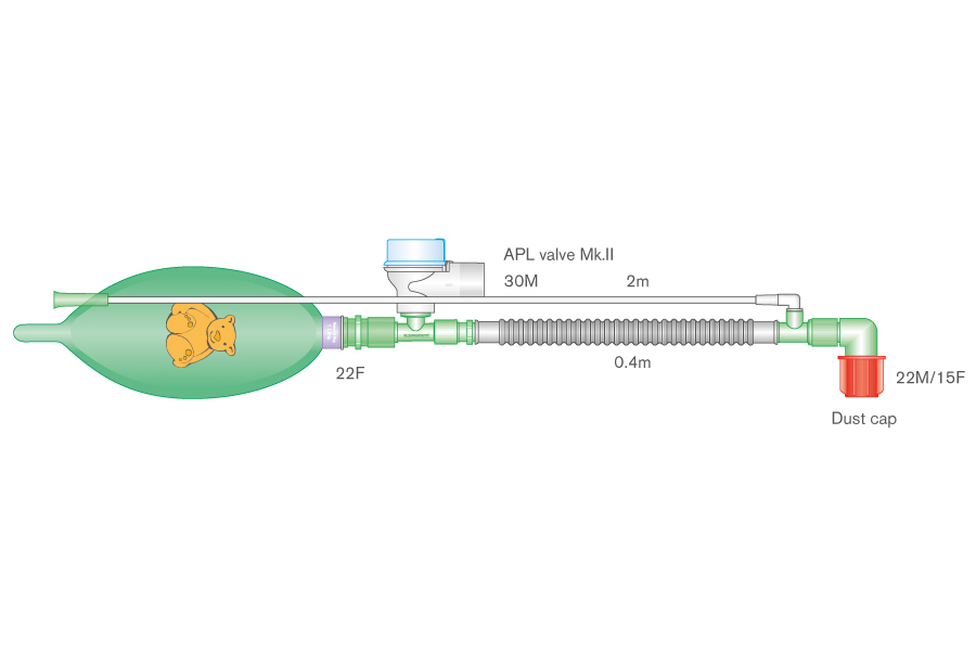 Paediatric, Mapleson D Bain deluxe coaxial breathing system with 1.0L closed tail bag, ≥ 2.1m